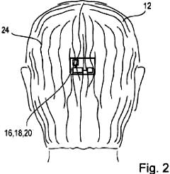 Sony Patents a Smart Wig (white male back view) - RF Cafe